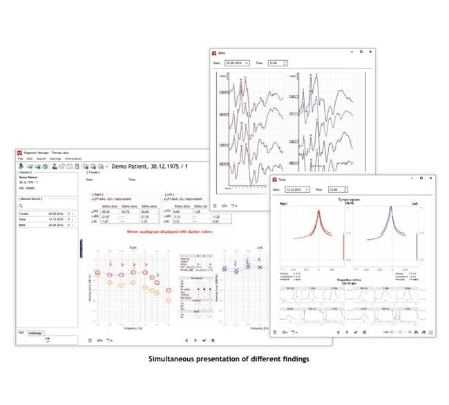 Audiological Equipment